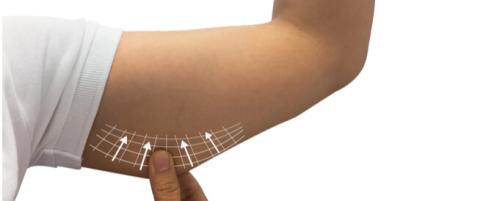 الترافورمر 3 لشد الترهلات